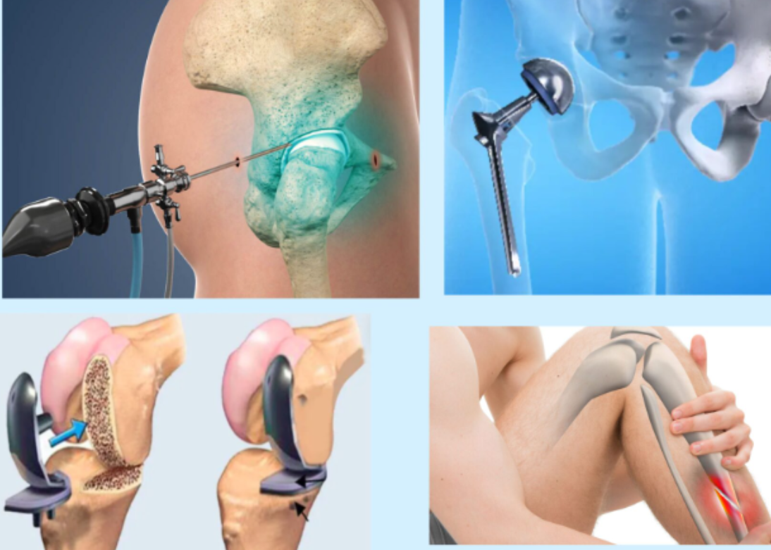 Orthopedic Procedures